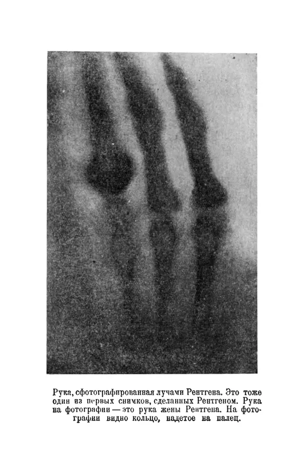 Матвей Бронштейн - Лучи икс - Страница № 31