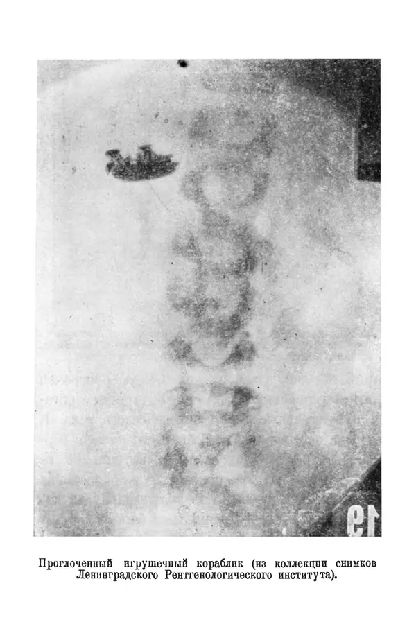 Матвей Бронштейн - Лучи икс - Страница № 61